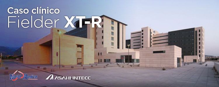 Caso Clínico Fielder XT-R en Complejo Hospitalario Universitario de Granada