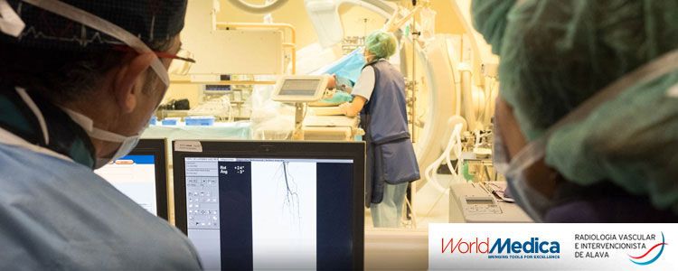 Embolización Osteoarticular realizada en la Unidad de Radiología Vascular Intervencionista de Álava (URVIA)