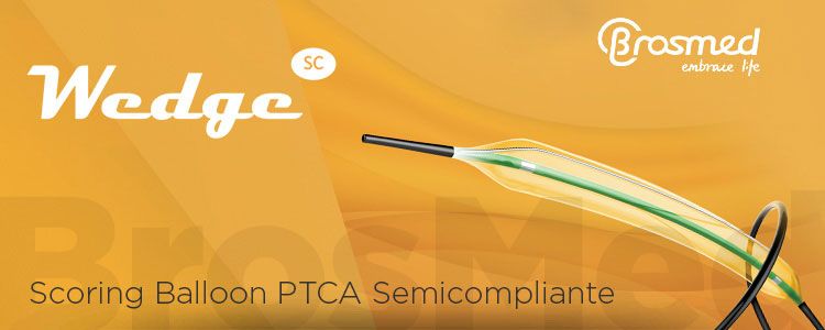 Wedge SC de BrosMed | Compañía representada por World Medica