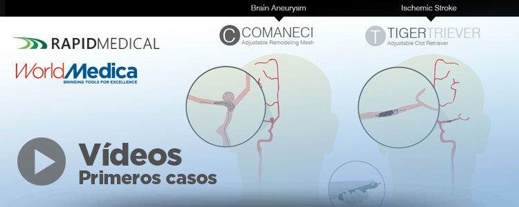[Vídeos] Primeros Casos con Comaneci y Tigertriever, de Rapid Medical