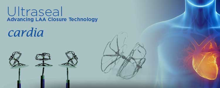 Ultraseal de Cardia | Compañía representada por World Medica