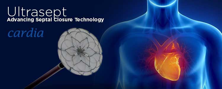 Ultrasept de Cardia | Compañía representada por World Medica